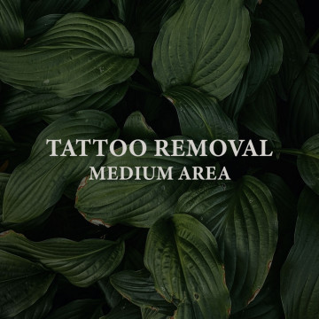 Image for Tattoo Removal - Medium Area