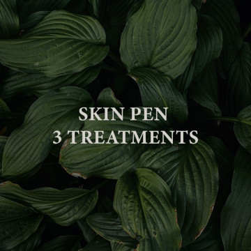 Image for Skin Pen Microneedling  – 3 Treatments