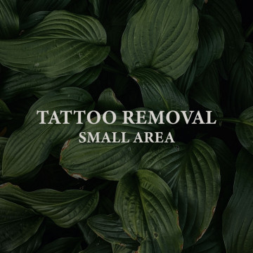 Image for Tattoo Removal - Small Area